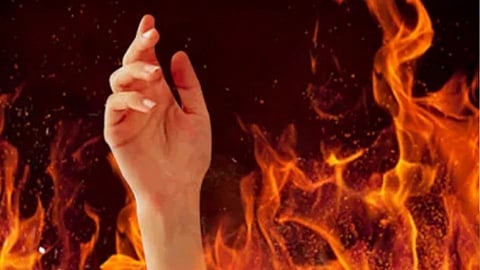 Woman dies after being severely burnt by fire In Sakinaka