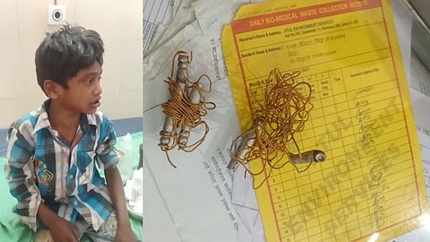 जिंतूरमध्ये जिलेटीन कांड्यांचा भीषण स्फोट; दोन बालक गंभीर जखमी!