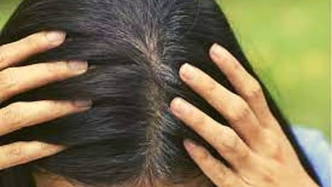 Hair Natural remedies