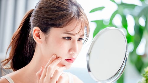 Oily Skin In rainy Season, Oily Skin Care Tips, Skin Care In Rainy Season