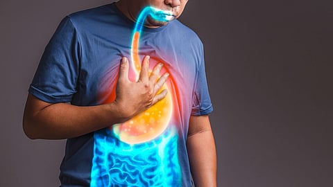 How do you relieve heartburn, Home remedies, health tips for heartburn