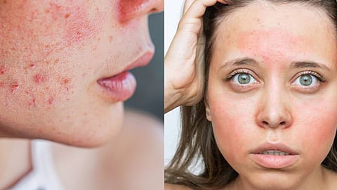 Makeup Mistake, Skin Care Tips, Skin Health