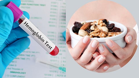 Hemoglobin Deficiency