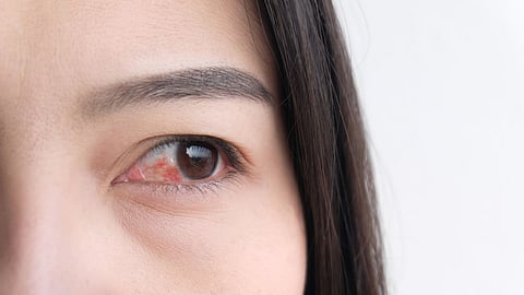 Eye Care Tips