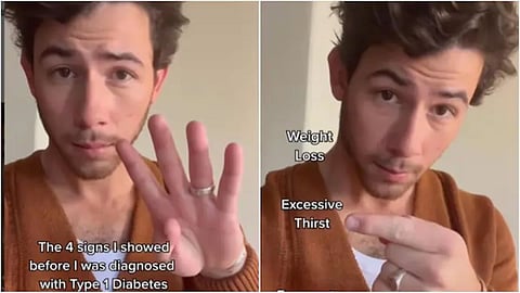 Nick Jonas Video