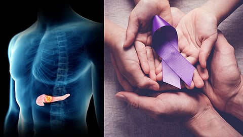 Pancreatic Cancer