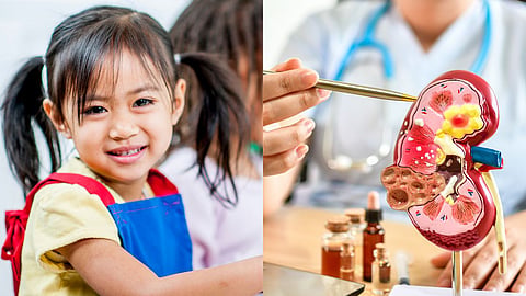 Kids Kidney Cancer