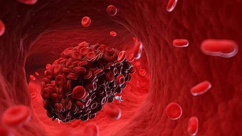 Blood Clotting