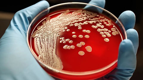 Superbug