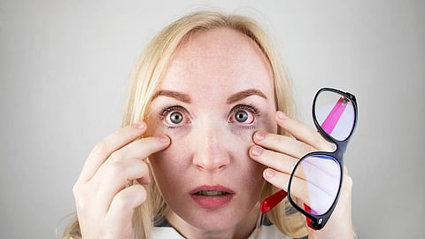 Red Eyes Infection