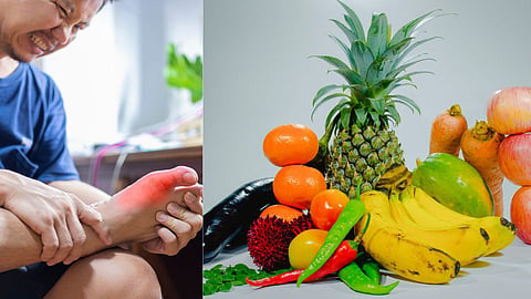 Causes of Uric Acid