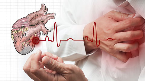 Heart Attack Symptoms