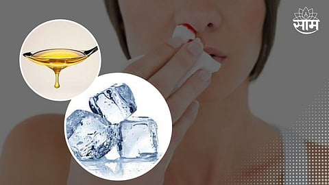 Nose Bleeding Remedies