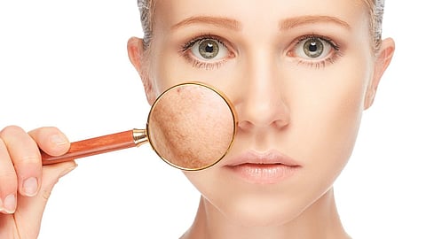 Skin Care Tips