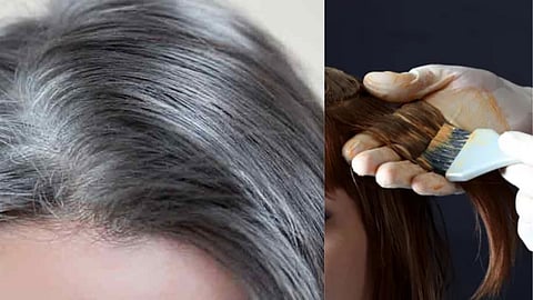 White Hair Home Remedies