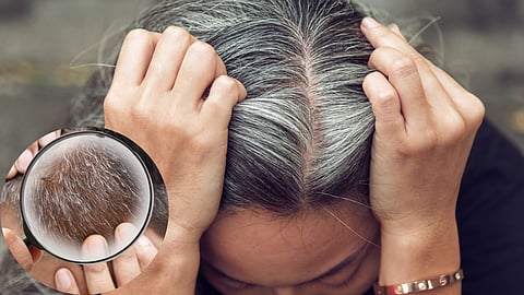 White Hair Problem