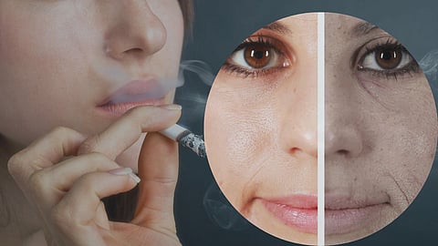 Smoking Affects On Skin