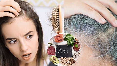 How To Prevent White Hair