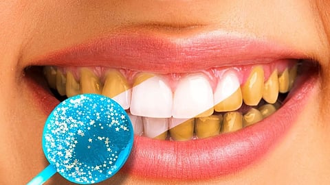 Teeth Whitening Tips : दातांचा पिवळेपणा काही केल्या जात नाही? हे घरगुती उपाय करुन पाहा, मोत्यासारखे चमकतील