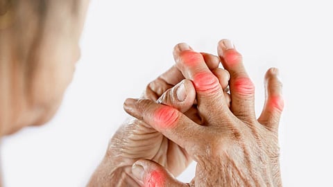 World Arthritis Day 2023