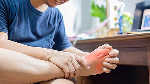 High Uric Acid