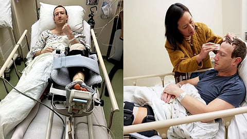 Mark Zuckerberg Injury: