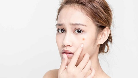 Teenage Skin Care