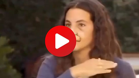 Dog Bite Women Face