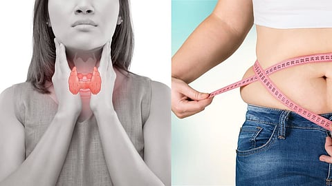 Thyroid Disease