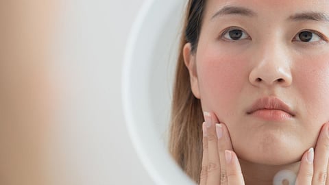 After Facial Care Tips: फेशियल केल्यानंतर चुकूनही करु नका या चुका; त्वचेला सतत सुटेल खाज, येतील रॅशेस