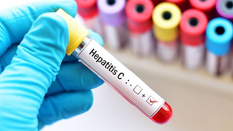 Hepatitis B and C