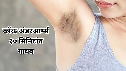 Dark Underarms
