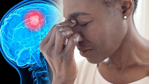 Symptoms of Brain Tumor