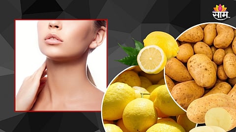 Dark Neck Home Remedies