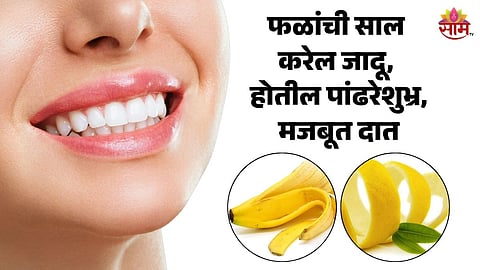 Teeth Whitening Tips