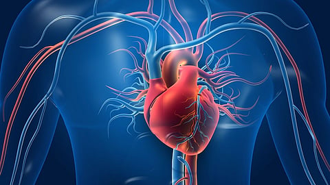 Coronary Artery Blockage