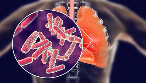 Anti-TB drug