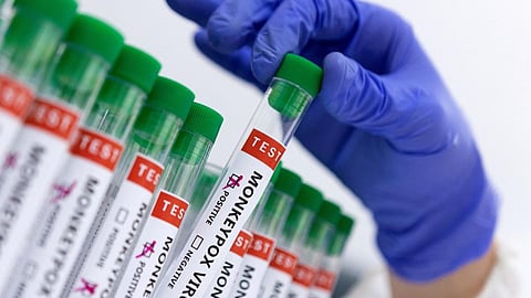 Monkeypox: कोरोना व्हायरसनंतर मंकीपॉक्सची दहशत; मंकीपॉक्स व्हायरसचा 116 देशांना धोका