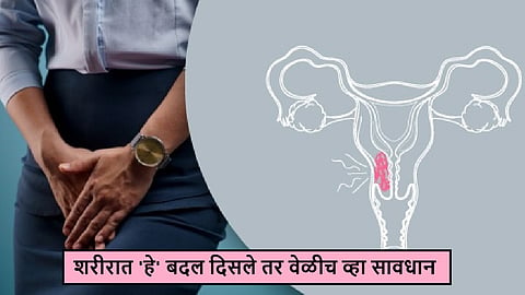 Uterus cancer symptoms