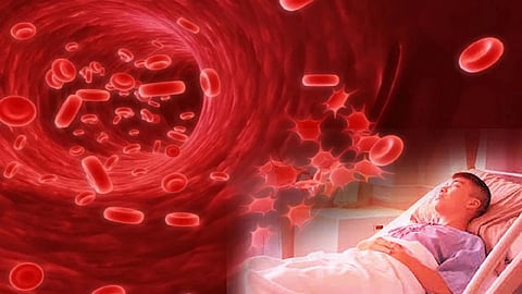 Symptoms Of Low Platelets Count