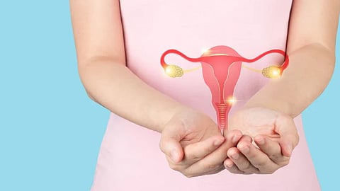 PCOS cases