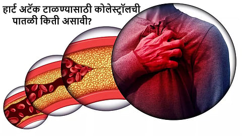 Cholesterol Levels - What You Need to Know