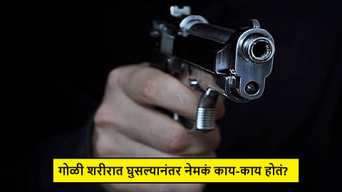 Injured From Bullet
