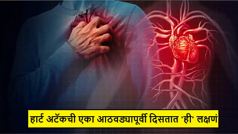 heart attack