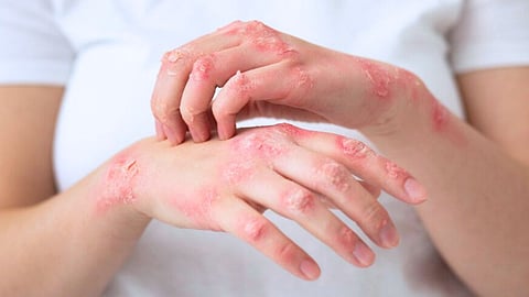 skin problems