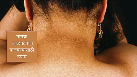 Neck Tanning Removal Tips :