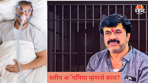 वाल्मिक कराडला झालेला 'स्लीप अॅपनिया' नेमका आजार काय? वाचा