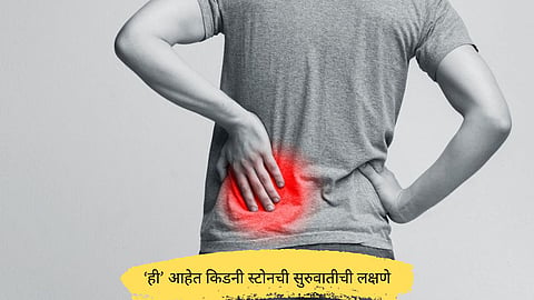 Kidney Stone Symtoms