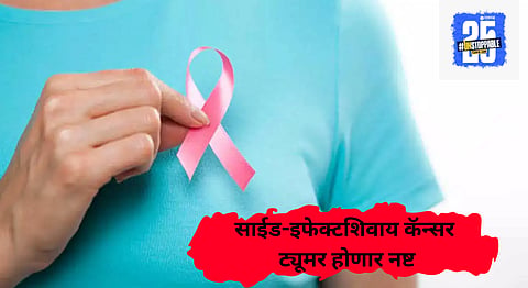 breast cancer treatment