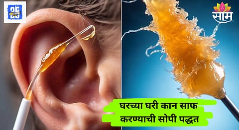 Earwax: घरीच काही मिनिटांत काढता येईल कानातील घाण; कान साफ करण्याचे सर्वात सोपे-सुरक्षित उपाय पाहाच
